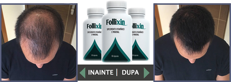 Folliskin -pareri, pret, forum, efecte si beneficii
